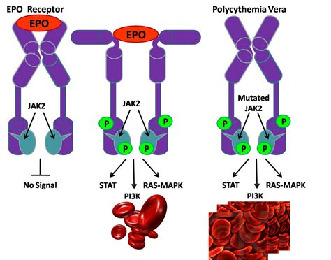 Jak2 (janus Kinase 2) V617f Test .